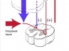 descending-inhibition