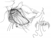 gracilis-graft