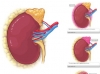 kidney-screenshots