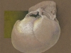 skull_lobectomy