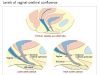 vaginal-urethral-confluence